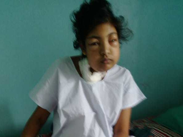 Support young Shalet Undergo Kidney Transplantation!