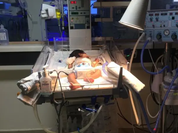 Support Baby of Shanti To Recover!