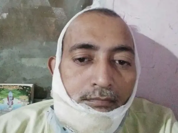 Help Mukesh Fight Oral Cancer