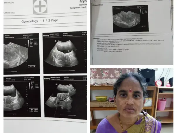 Help My Aunt Get Treated