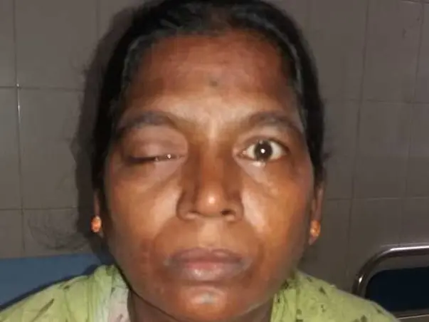 Help My Mother Fight Neuro Disease