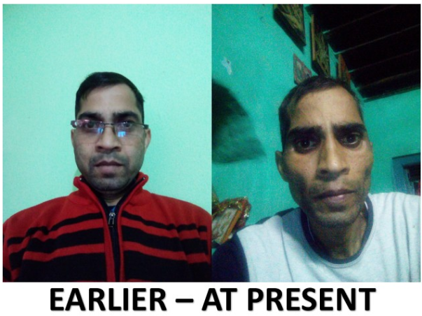 Help Me Fight Against Liver Cancer