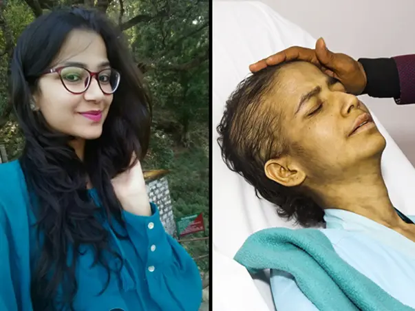 Help my friend Himani Joshi fight Blood Cancer