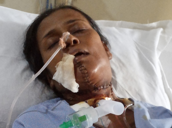 Help My Mother Fight Cancer