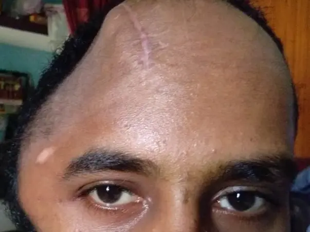 Help Anandhan Recover From An Accident