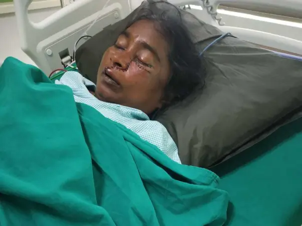 Please Help My Mother (Nilaveni), Fight Fungal Infection