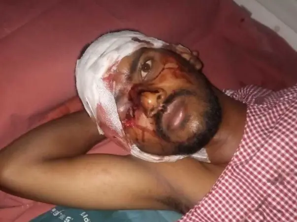 Help Rakesh To Recover From An Accident