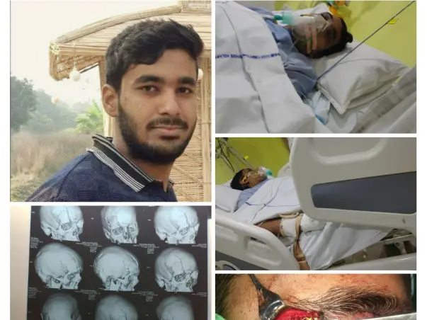 My Brother Is Struggling With Multiple Skulls, Facial Bones Fracture And Brain Injury, Help Him