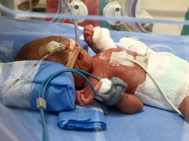 Please help me save my baby!!!