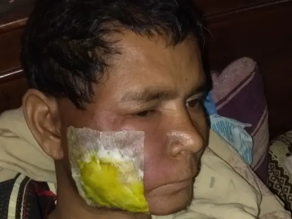 Help My Uncle Fight This Battle