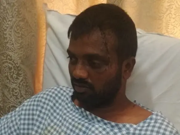 Support Manohar Recover From Head Injury