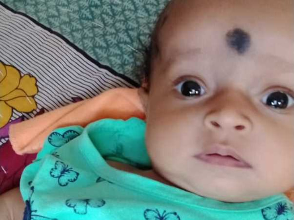 5 Months Old Baby Prapti Panda Needs Your Help Fight Osteopetrosis