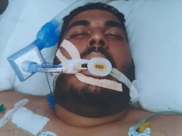 23 Yrs Old Abhishek Sharma Needs Your Help To Fight Pancreatitis