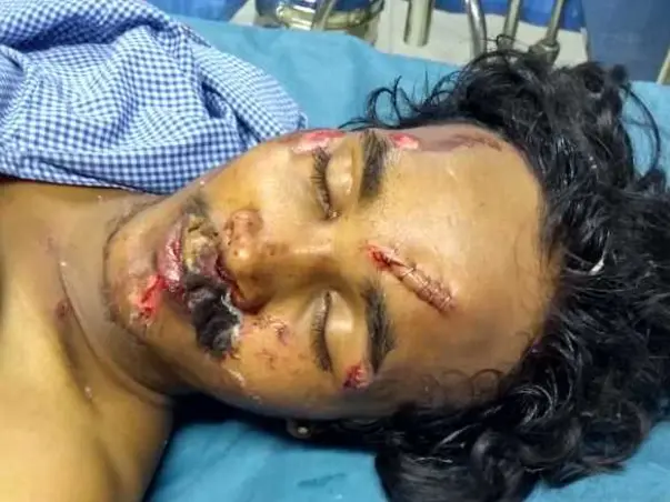 Help Tarun Recover