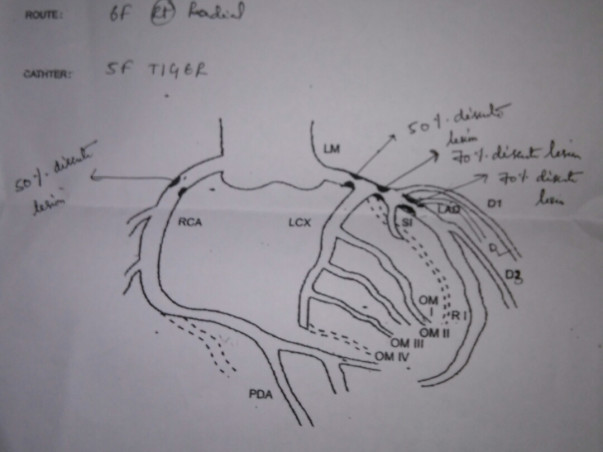 Need Funds For My Father For Heart Surgery.