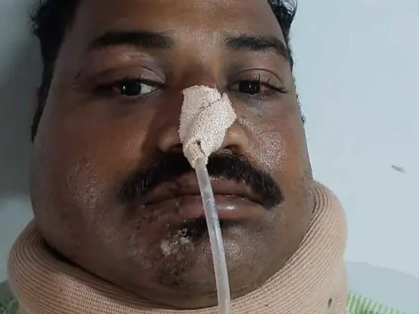 32 years old Prashant Rajpurkar needelp fight Multiple Skull Fractures