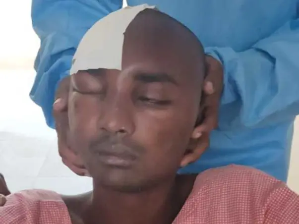 Support R Arun Kumar Recover From Cerebrovascular Accident
