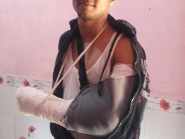 Help Ajay To Revive Fracture