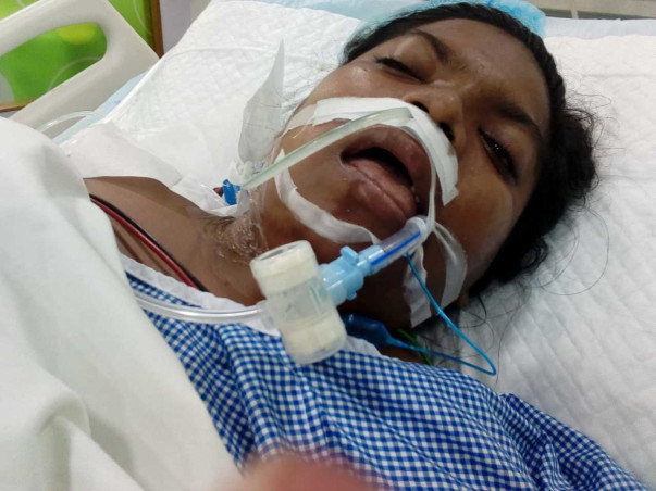21 Years Old Simran Nayak Needs Your Help Fight Road Traffic Accident