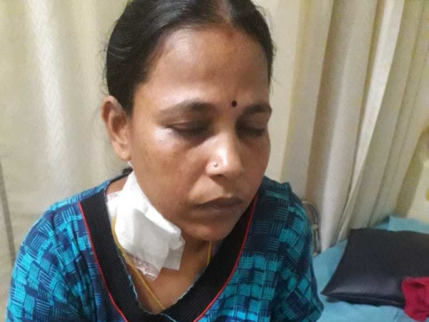 Help Selvi Undergo Kidney Transplant
