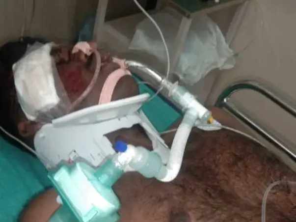 Support Devakar recover from Road traffic accident