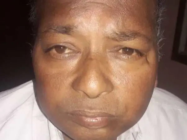 Help My Father Recover From Kidney Failure