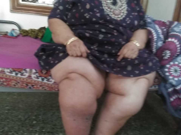 Support Uma Rao recover from Multi Organ Failure