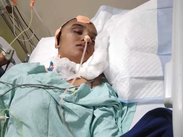 Help My Friend Swati, She Met With A Road Accident
