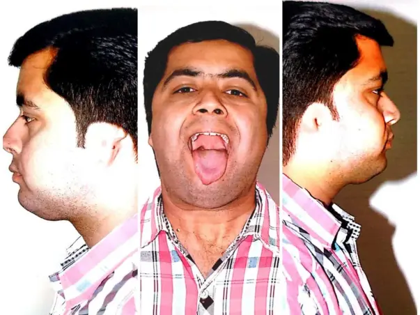 27 Years Old Shubam Dilip Gohil Needs Your Help Fight Deaf And Dumb