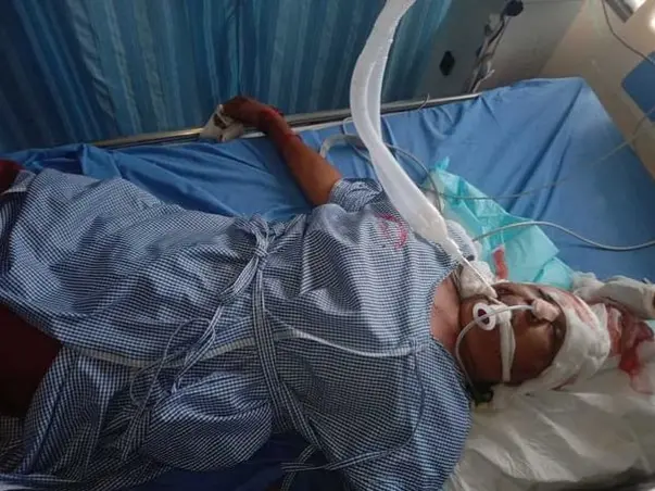 Support Gowrabai mother of 6 children, Recover From Head Injury