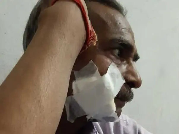 My Father Is Struggling With Oral Cancer, Help Him