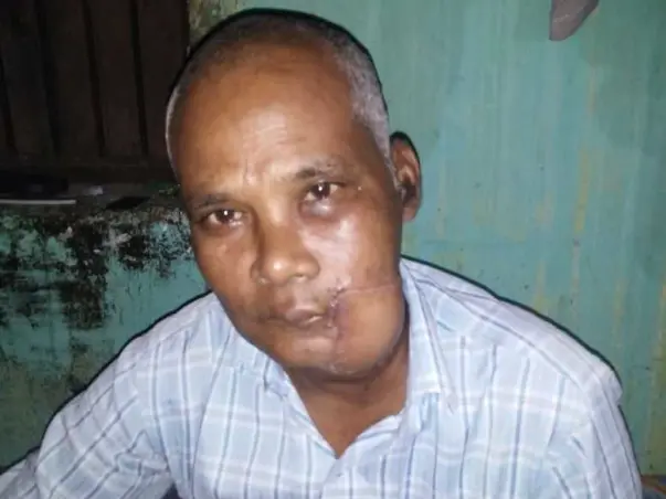Help Dushmanta Fight Cancer