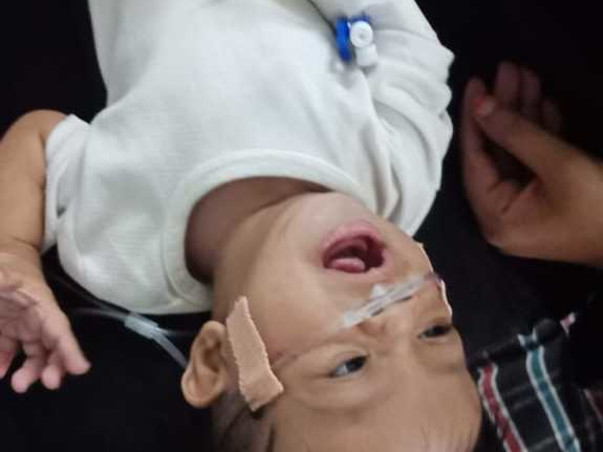 SAVE 8 months child from SEVERE LHD,BRONCHOPNEUMONIA RESPIRATORY DISTR