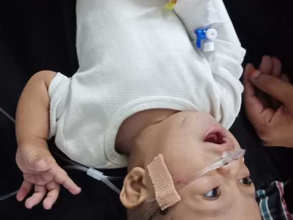 SAVE 8 months child from SEVERE LHD,BRONCHOPNEUMONIA RESPIRATORY DISTR