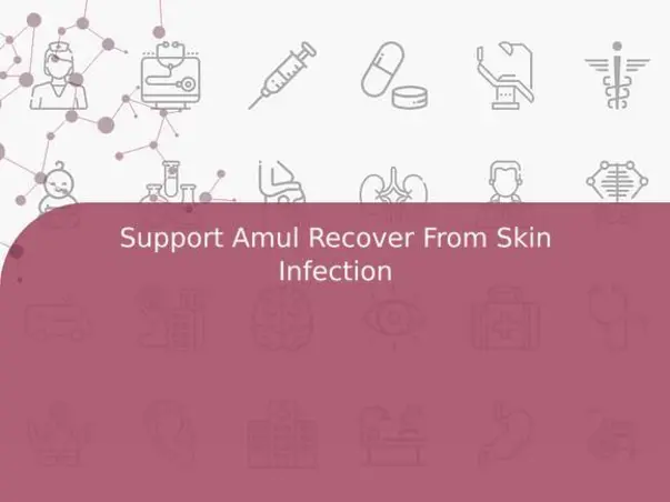 Support Amul Recover From Skin Infection