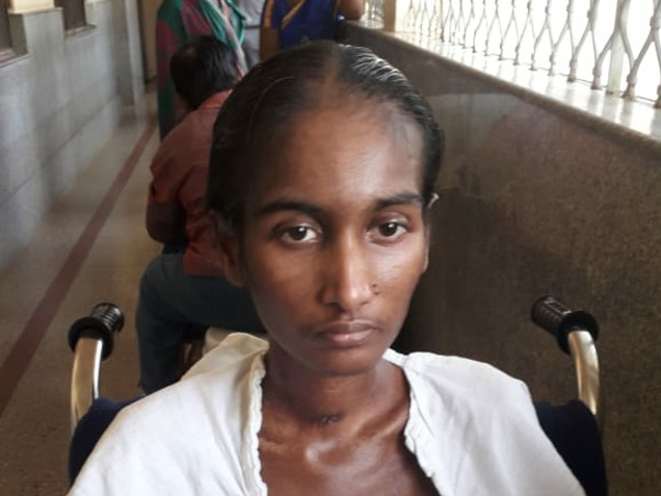 Help Me Wife Recover From A Rare Autoimmune Disease.