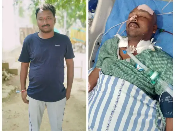 My Uncle Is Struggling With Coma And Paralysis, Help Him