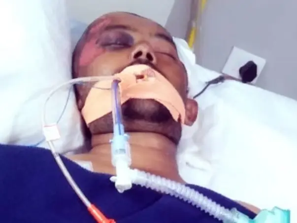 Support Sunil Kumar To Recover From Accident Injuries