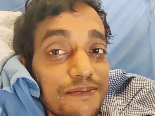 31 Years Old Chetan Kumar Needs Your Help Fight Liver Failure