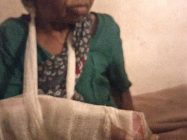Help Balamma, 80, a destitute, cover surgery costs for  fractures