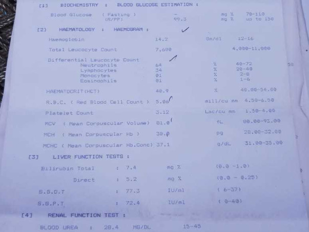 24 Years Old Gulshan Kumar Needs Your Help To Fight For Liver Infection