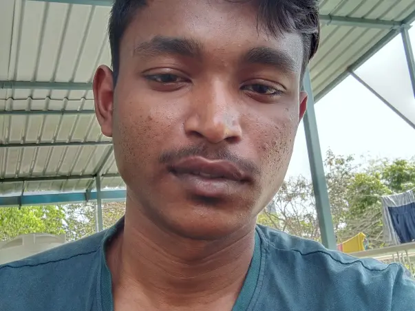 21 Years Old Nayak Needs Your Help Fight Congenital Tuberculosis
