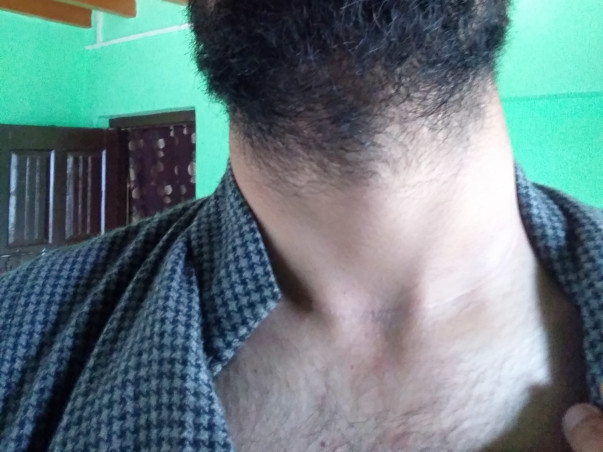 Help Sartaj Ahmad Bhat Recover From Throat Cancer