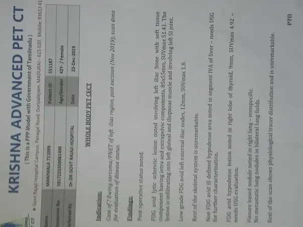 I’m struggling with Ewing's Sarcoma rare type of cancer, help me