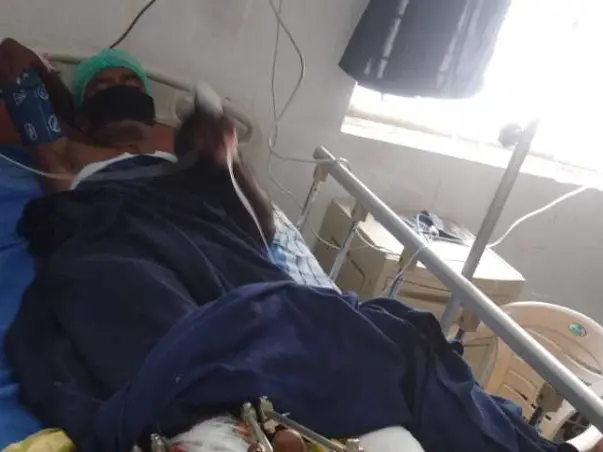 50 Years Old Venkat Raju Needs Your Help Fight Accident (Leg Injury)