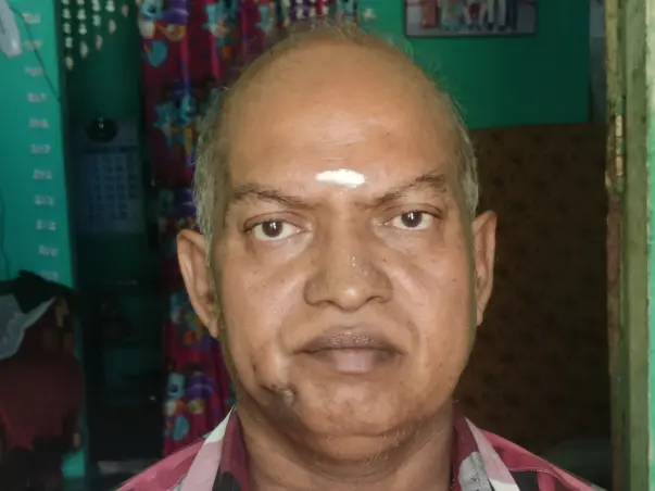 My Father Is Struggling With Oral Cancer, Help Him