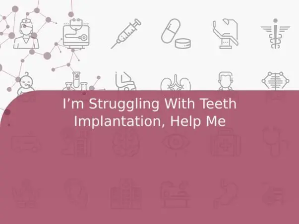 I’m Struggling With Teeth Implantation, Help Me