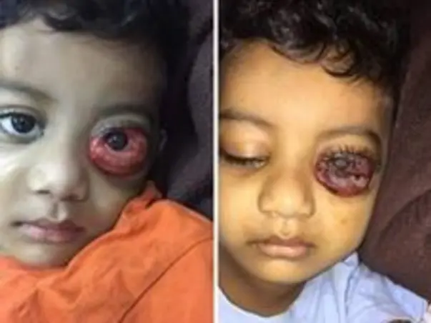 Please Help  Goutham Kaloji Recover From Leukemia