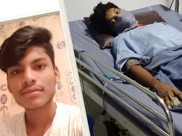 Sai Bhargav Is Struggling With Leg and spinal cord Injury, Help Him
