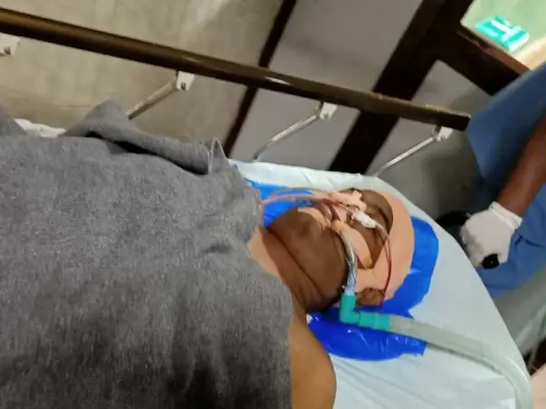27 Years Old Dinesh Needs Your Help Recover Accident Injuries(Multiple Injuries)